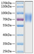 Human LFA-3/CD58 protein (Recombinant) (C-hFc&His) (STJP001027)