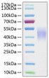 Human Fc-gamma RIII beta/CD16b protein (Recombinant) (C-His) (STJP001060)