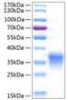 Human IFN-lambda 1/IL-29 protein (Recombinant) (C-His) (STJP001077)