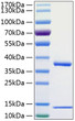 Human FcRn protein (Active Recombinant) (C-His (FCGRT) &No tag (B2M)) (STJP001116)