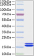 Human IL-2 protein (Active Recombinant) (C-His) (STJP001119)