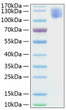 Human CEA/CD66e protein (Recombinant) (C-His) (STJP001168)