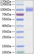 Human Siglec-9/CD329 protein (Recombinant) (C-hFc&His) (STJP001208)