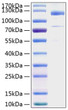 Human Thrombospondin-1/THBS1 protein (Recombinant) (C-His) (STJP001211)