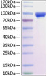 Rat MMP-9 protein (Recombinant) (C-His) (STJP001226)