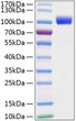 Mouse MMP-9 protein (Recombinant) (C-His) (STJP001240)