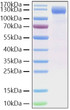 SARS-CoV-2 Spike S1 (D614G) protein (Active Recombinant) (C-His) (STJP001279)