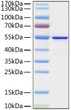 MERS-CoV Nucleocapsid protein (Recombinant) (C-His) (STJP001291)