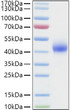 Human Dkk-1 protein (Recombinant) (C-His) (STJP001340)