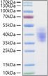 Human NKAT-2/KIR2DL3/CD158b2 protein (Recombinant) (C-His) (STJP001378)