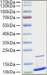 Human CXCL3/GRO-gamma/MIP2-beta protein (Recombinant) (No tag) (STJP001397)