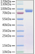 Human Endoglin/CD105 protein (Recombinant) (C-His) (STJP001405)