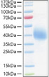 Human TFPI protein (Active Recombinant) (C-His) (STJP001426)