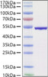 SARS-COV-2 Nucleocapsid (B.1.1.529/Omicron) protein (Recombinant) (C-His) (STJP001478)