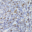 Immunohistochemistry analysis of paraffin-embedded human tonsil using Smad2 Rabbit polyclonal antibody (STJ11103803) at dilution of 1:100 (40x lens). Perform high pressure antigen retrieval with 10 mM citrate buffer pH 6. 0 before commencing with immunohistochemistry staining protocol.