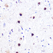 Immunohistochemistry analysis of ATF2 in paraffin-embedded mouse spinal cord using ATF2 Rabbit polyclonal antibody (STJ11103811) at dilution of 1:100 (40x lens). Perform microwave antigen retrieval with 10 mM PBS buffer pH 7. 2 before commencing with immunohistochemistry staining protocol.