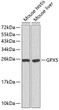 Western blot analysis of extracts of various cell lines, using GPX5 antibody (STJ11103820). Secondary antibody: HRP Goat Anti-Rabbit IgG (H+L) (STJS000856) at 1:10000 dilution. Lysates/proteins: 25 Mu g per lane. Blocking buffer: 3% nonfat dry milk in TBST.