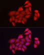 Immunofluorescence analysis of HeLa cells using NUR77 Rabbit polyclonal antibody (STJ11103838) at dilution of 1:50 (40x lens). Blue: DAPI for nuclear staining.