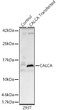 Western blot analysis of lysates from wild type (WT) and 293T cells transfected with CALCA, using CALCA Rabbit polyclonal antibody (STJ11103842) at 1:500 dilution. Secondary antibody: HRP Goat Anti-Rabbit IgG (H+L) (STJS000856) at 1:10000 dilution. Lysates/proteins: 25 Mu g per lane. Blocking buffer: 3% nonfat dry milk in TBST. Detection: ECL Basic Kit. Exposure time: 1s.