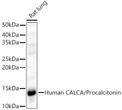 Western blot analysis of lysates from Rat lung, using CALCA Rabbit polyclonal antibody (STJ11103842) at 1:400 dilution. Secondary antibody: HRP Goat Anti-Rabbit IgG (H+L) (STJS000856) at 1:10000 dilution. Lysates/proteins: 25 Mu g per lane. Blocking buffer: 3% nonfat dry milk in TBST. Detection: ECL Enhanced Kit. Exposure time: 180s.