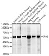 Western blot analysis of extracts of various tissues from the japonica rice (Oryza sativa L. ) variety Zhonghua 11, using IPA1 Rabbit polyclonal antibody (STJ11103879) at 1:1000 dilution. Secondary antibody: HRP Goat Anti-Rabbit IgG (H+L) (STJS000856) at 1:10000 dilution. Lysates/proteins: 25 Mu g per lane. Blocking buffer: 3% nonfat dry milk in TBST. Detection: ECL Enhanced Kit. Exposure time: 600s.