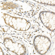 Immunohistochemistry analysis of paraffin-embedded human colon using RGS2 Rabbit polyclonal antibody (STJ11103885) at dilution of 1:100 (40x lens). Perform high pressure antigen retrieval with 10 mM citrate buffer pH 6. 0 before commencing with immunohistochemistry staining protocol.