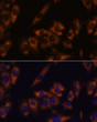 Immunofluorescence analysis of C6 cells using GRID2 Rabbit polyclonal antibody (STJ11103921) at dilution of 1:100. Secondary antibody: Cy3 Goat Anti-Rabbit IgG (H+L) at 1:500 dilution. Blue: DAPI for nuclear staining.