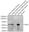 Western blot analysis of extracts of various tissues from the japonica rice (Oryza sativa L. ) variety Zhonghua 11, using NAL1 Rabbit polyclonal antibody (STJ11103932) at 1:1000 dilution. Secondary antibody: HRP Goat Anti-Rabbit IgG (H+L) (STJS000856) at 1:10000 dilution. Lysates/proteins: 25 Mu g per lane. Blocking buffer: 3% nonfat dry milk in TBST. Detection: ECL Enhanced Kit. Exposure time: 60s.
