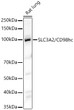 Western blot analysis of lysates from Rat lung, using SLC3A2/CD98hc Rabbit polyclonal antibody (STJ11103936) at 1:1000 dilution. Secondary antibody: HRP Goat Anti-Rabbit IgG (H+L) (STJS000856) at 1:10000 dilution. Lysates/proteins: 25 Mu g per lane. Blocking buffer: 3% nonfat dry milk in TBST. Detection: ECL Basic Kit. Exposure time: 60s.