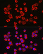 Immunofluorescence analysis of Neuro-2a cells using APP Rabbit polyclonal antibody (STJ11103984) at dilution of 1:50 (40x lens). Secondary antibody: Cy3 Goat Anti-Rabbit IgG (H+L) at 1:500 dilution. Blue: DAPI for nuclear staining.