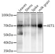 Western blot analysis of extracts of various tissues from the japonica rice (Oryza sativa L. ) variety Zhonghua 11, using AET1 Rabbit polyclonal antibody (STJ11103991) at 1:1000 dilution. Secondary antibody: HRP Goat Anti-Rabbit IgG (H+L) (STJS000856) at 1:10000 dilution. Lysates/proteins: 25 Mu g per lane. Blocking buffer: 3% nonfat dry milk in TBST. Detection: ECL Enhanced Kit. Exposure time: 10s.