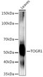 Western blot analysis of extracts of various tissues from the japonica rice (Oryza sativa L. ) variety Zhonghua 11, using TOGR1 Rabbit polyclonal antibody (STJ11104007) at 1:1000 dilution. Secondary antibody: HRP Goat Anti-Rabbit IgG (H+L) (STJS000856) at 1:10000 dilution. Lysates/proteins: 25 Mu g per lane. Blocking buffer: 3% nonfat dry milk in TBST. Detection: ECL Enhanced Kit. Exposure time: 60s. Western blot analysis of extracts of various tissues from the japonica rice (Oryza sativa L. ) variety Zhonghua 11, using TOGR1 Rabbit polyclonal antibody (STJ11104007) at 1:1000 dilution. Secondary antibody: HRP Goat Anti-Rabbit IgG (H+L) (STJS000856) at 1:10000 dilution. Lysates/proteins: 25 Mu g per lane. Blocking buffer: 3% nonfat dry milk in TBST. Detection: ECL Enhanced Kit. Exposure time: 60s.