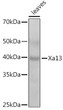 Western blot analysis of extracts of various tissues from the japonica rice (Oryza sativa L. ) variety Zhonghua 11, using Xa13 Rabbit polyclonal antibody (STJ11104017) at 1:1000 dilution. Secondary antibody: HRP Goat Anti-Rabbit IgG (H+L) (STJS000856) at 1:10000 dilution. Lysates/proteins: 25 Mu g per lane. Blocking buffer: 3% nonfat dry milk in TBST. Detection: ECL Enhanced Kit. Exposure time: 60s.