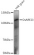 Western blot analysis of extracts of various tissues from the japonica rice (Oryza sativa L. ) variety Zhonghua 11, using OsARF23 Rabbit polyclonal antibody (STJ11104023) at 1:1000 dilution. Secondary antibody: HRP Goat Anti-Rabbit IgG (H+L) (STJS000856) at 1:10000 dilution. Lysates/proteins: 25 Mu g per lane. Blocking buffer: 3% nonfat dry milk in TBST. Detection: ECL Enhanced Kit. Exposure time: 30s. Western blot analysis of extracts of various tissues from the japonica rice (Oryza sativa L. ) variety Zhonghua 11, using OsARF23 Rabbit polyclonal antibody (STJ11104023) at 1:1000 dilution. Secondary antibody: HRP Goat Anti-Rabbit IgG (H+L) (STJS000856) at 1:10000 dilution. Lysates/proteins: 25 Mu g per lane. Blocking buffer: 3% nonfat dry milk in TBST. Detection: ECL Enhanced Kit. Exposure time: 30s.