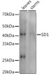 Western blot analysis of extracts of various tissues from the japonica rice (Oryza sativa L. ) variety Zhonghua 11, using SD1 Rabbit polyclonal antibody (STJ11104043) at 1:1000 dilution. Secondary antibody: HRP Goat Anti-Rabbit IgG (H+L) (STJS000856) at 1:10000 dilution. Lysates/proteins: 25 Mu g per lane. Blocking buffer: 3% nonfat dry milk in TBST. Detection: ECL Enhanced Kit. Exposure time: 30s.