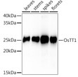 Western blot analysis of extracts of various tissues from the japonica rice (Oryza sativa L. ) variety Zhonghua 11, using OsTT1 Rabbit polyclonal antibody (STJ11104055) at 1:1000 dilution. Secondary antibody: HRP Goat Anti-Rabbit IgG (H+L) (STJS000856) at 1:10000 dilution. Lysates/proteins: 25 Mu g per lane. Blocking buffer: 3% nonfat dry milk in TBST. Detection: ECL Basic Kit. Exposure time: 60s.