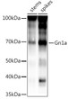 Western blot analysis of extracts of various tissues from the japonica rice (Oryza sativa L. ) variety Zhonghua 11, using Gn1a Rabbit polyclonal antibody (STJ11104056) at 1:1000 dilution. Secondary antibody: HRP Goat Anti-Rabbit IgG (H+L) (STJS000856) at 1:10000 dilution. Lysates/proteins: 25 Mu g per lane. Blocking buffer: 3% nonfat dry milk in TBST. Detection: ECL Basic Kit. Exposure time: 60s.