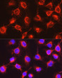 Immunofluorescence analysis of PC-3 cells using UGT2B17 Rabbit polyclonal antibody (STJ11104058) at dilution of 1:200 (40x lens). Blue: DAPI for nuclear staining.