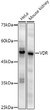 Western blot analysis of extracts of various cell lines, using VDR antibody (STJ11104082) at1:1000 dilution. Secondary antibody: HRP Goat Anti-Rabbit IgG (H+L) (STJS000856) at1:10000 dilution. Lysates/proteins: 25 Mu g per lane. Blocking buffer: 3% nonfat dry milk in TBST. Detection: ECL Enhanced Kit. Exposure time: 90s.