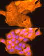 Immunofluorescence analysis of A431 cells using LORICRIN Rabbit polyclonal antibody (STJ11104151) at dilution of 1:200 (40x lens). Blue: DAPI for nuclear staining.