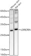 Western blot analysis of extracts of various cell lines, using LORICRIN antibody (STJ11104151) at 1:1000 dilution. Secondary antibody: HRP Goat Anti-Rabbit IgG (H+L) (STJS000856) at 1:10000 dilution. Lysates/proteins: 25 Mu g per lane. Blocking buffer: 3% nonfat dry milk in TBST. Detection: ECL Basic Kit. Exposure time: 3s.