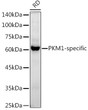 Western blot analysis of extracts of RD cells, using PKM1-specific antibody (STJ11104157) at1:1000 dilution. Secondary antibody: HRP Goat Anti-Rabbit IgG (H+L) (STJS000856) at1:10000 dilution. Lysates/proteins: 25 Mu g per lane. Blocking buffer: 3% nonfat dry milk in TBST. Detection: ECL Basic Kit. Exposure time: 60s.