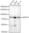 Western blot analysis of various lysates, using NPHP1 Rabbit monoclonal antibody (STJ11104167) at 1:1000 dilution. Secondary antibody: HRP Goat Anti-Rabbit IgG (H+L) (STJS000856) at1:10000 dilution. Lysates/proteins: 25 Mu g per lane. Blocking buffer: 3% nonfat dry milk in TBST. Detection: ECL Basic Kit. Exposure time: 180s.