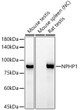 Western blot analysis of various lysates, using NPHP1 Rabbit monoclonal antibody (STJ11104167) at 1:1000 dilution. Secondary antibody: HRP Goat Anti-Rabbit IgG (H+L) (STJS000856) at1:10000 dilution. Lysates/proteins: 25 Mu g per lane. Blocking buffer: 3% nonfat dry milk in TBST. Detection: ECL Basic Kit. Negative control (NC) : Mouse spleenExposure time: 90s.