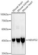 Western blot analysis of various lysates, using NDUFS2 Rabbit monoclonal antibody (STJ11104185) at1:1000 dilution. Secondary antibody: HRP Goat Anti-Rabbit IgG (H+L) (STJS000856) at 1:10000 dilution. Lysates/proteins: 25 Mu g per lane. Blocking buffer: 3% nonfat dry milk in TBST. Detection: ECL Basic Kit. Exposure time: 60s.