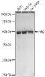 Western blot analysis of various lysates using PRD Rabbit monoclonal antibody (STJ11104188) at1:1000 dilution. Secondary antibody: HRP Goat Anti-Rabbit IgG (H+L) (STJS000856) at 1:10000 dilution. Lysates/proteins: 25 Mu g per lane. Blocking buffer: 3% nonfat dry milk in TBST. Detection: ECL Basic Kit. Exposure time: 1s.