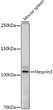 Western blot analysis of lysates from Mouse spleen, using Nesprin3 Rabbit monoclonal antibody (STJ11104212) at1:1000 dilution. Secondary antibody: HRP Goat Anti-Rabbit IgG (H+L) (STJS000856) at 1:10000 dilution. Lysates/proteins: 25 Mu g per lane. Blocking buffer: 3% nonfat dry milk in TBST. Detection: ECL Enhanced Kit. Exposure time: 180s.