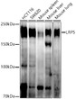 Western blot analysis of various lysates using LRP5 Rabbit monoclonal antibody (STJ11104221) at 1:1000 dilution. Secondary antibody: HRP Goat Anti-Rabbit IgG (H+L) (STJS000856) at 1:10000 dilution. Lysates/proteins: 25 Mu g per lane. Blocking buffer: 3% nonfat dry milk in TBST. Detection: ECL Enhanced Kit. Exposure time: 180s.