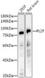 Western blot analysis of extracts of various cell lines, using PLZF antibody (STJ11104224) at 1:10000 dilution. Secondary antibody: HRP Goat Anti-Rabbit IgG (H+L) (STJS000856) at 1:10000 dilution. Lysates/proteins: 25 Mu g per lane. Blocking buffer: 3% nonfat dry milk in TBST. Detection: ECL Basic Kit. Exposure time: 90s.
