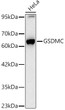 Western blot analysis of lysates from HeLa cells, using GSDMC Rabbit monoclonal antibody (STJ11104233) at 1:10000 dilution. Secondary antibody: HRP Goat Anti-Rabbit IgG (H+L) (STJS000856) at 1:10000 dilution. Lysates/proteins: 25ug per lane. Blocking buffer: 3% nonfat dry milk in TBST. Detection: ECL Basic Kit. Exposure time: 30s.